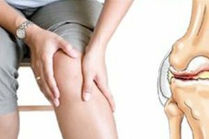 Лікування артрозу колінних суглобів гіалуроновою кислотою