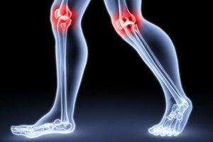 Чи ефективні ін'єкції гіалуронової кислоти в колінний суглоб